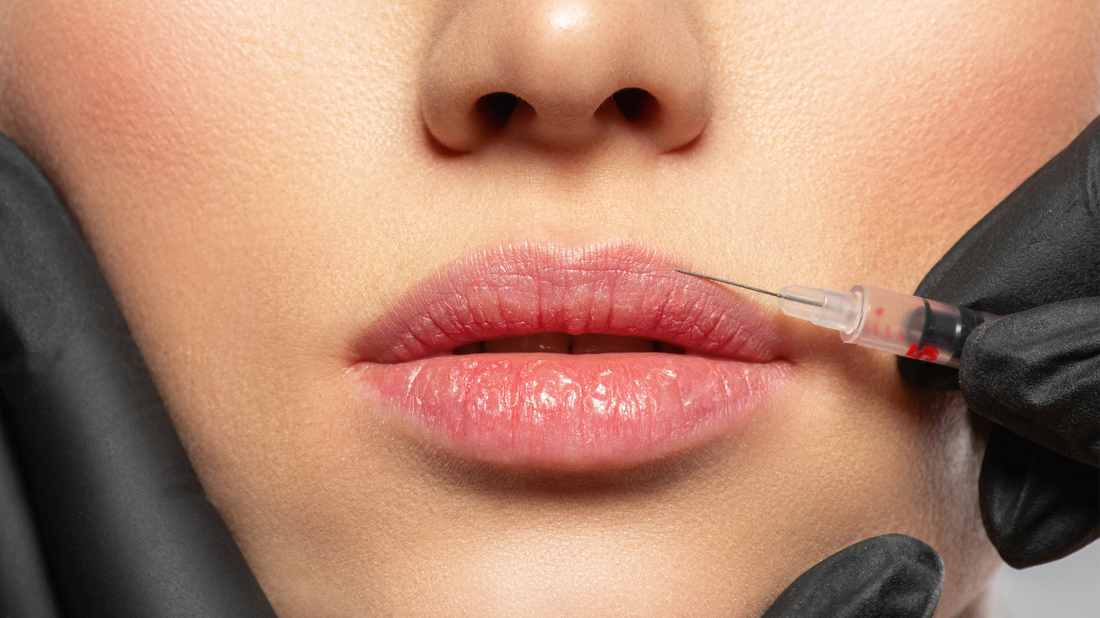 Fünf häufige Fehler bei Lippenunterspritzungen